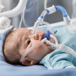 High Quality Advanced Bubble CPAP System for Neonates - Unrivalled Neonatal Respiratory Support